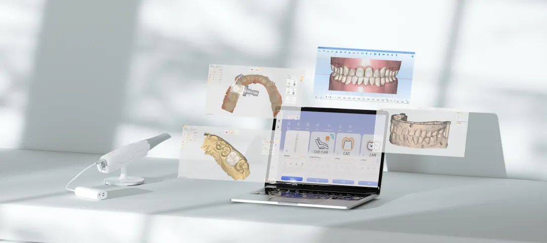 國(guó)內(nèi)首家齒科數(shù)字化CAD/CAM軟硬件研發(fā)企業(yè)落戶拱墅，推動(dòng)計(jì)算機(jī)系統(tǒng)集成創(chuàng)新發(fā)展
